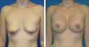 Before & After Photos